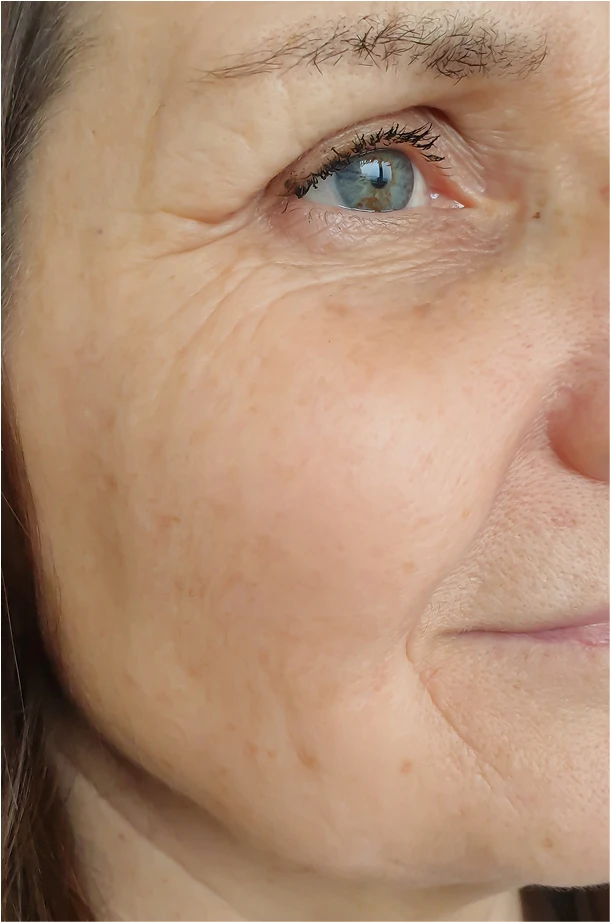 home-patients-before