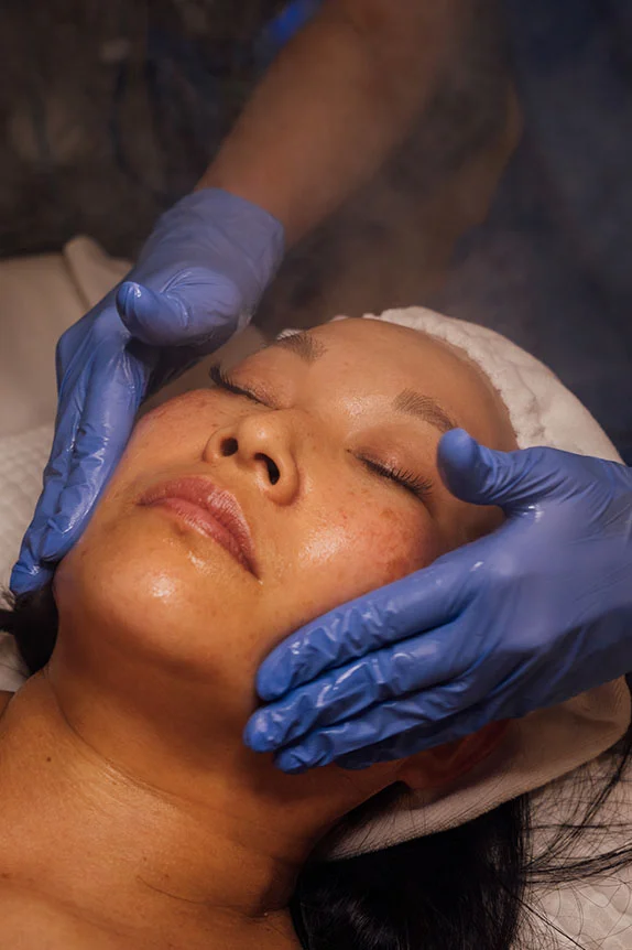 chemical-peels-intro